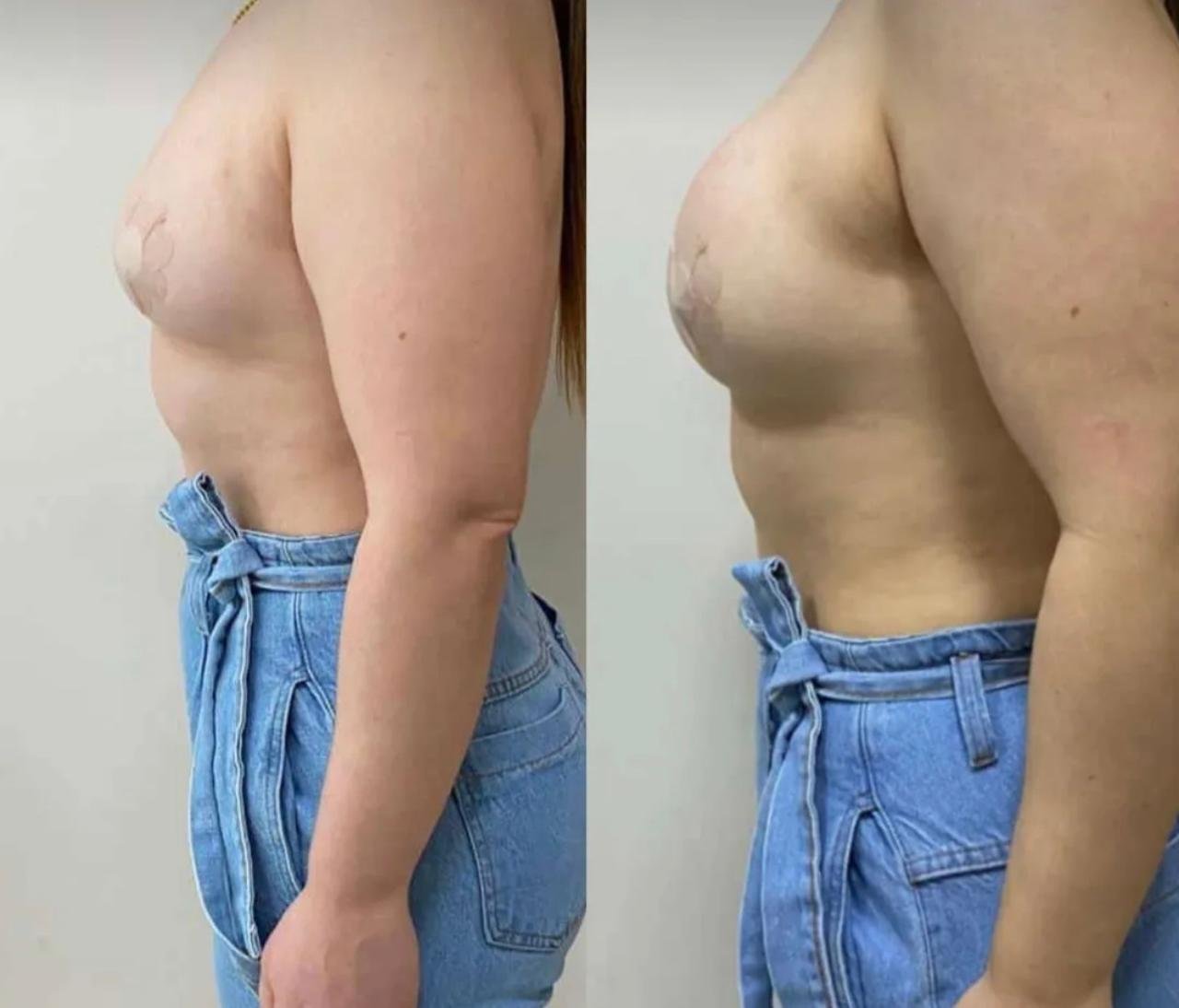 Estética Avançada