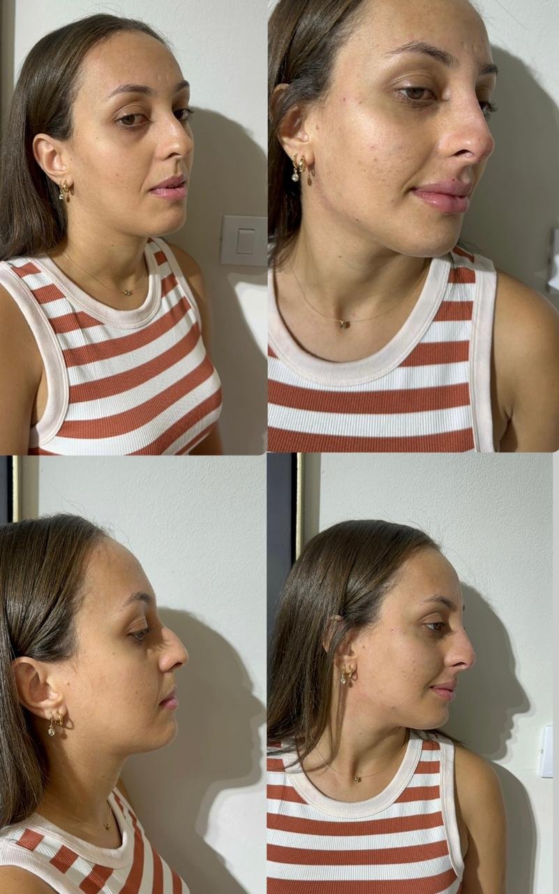 Protocolo de Pele